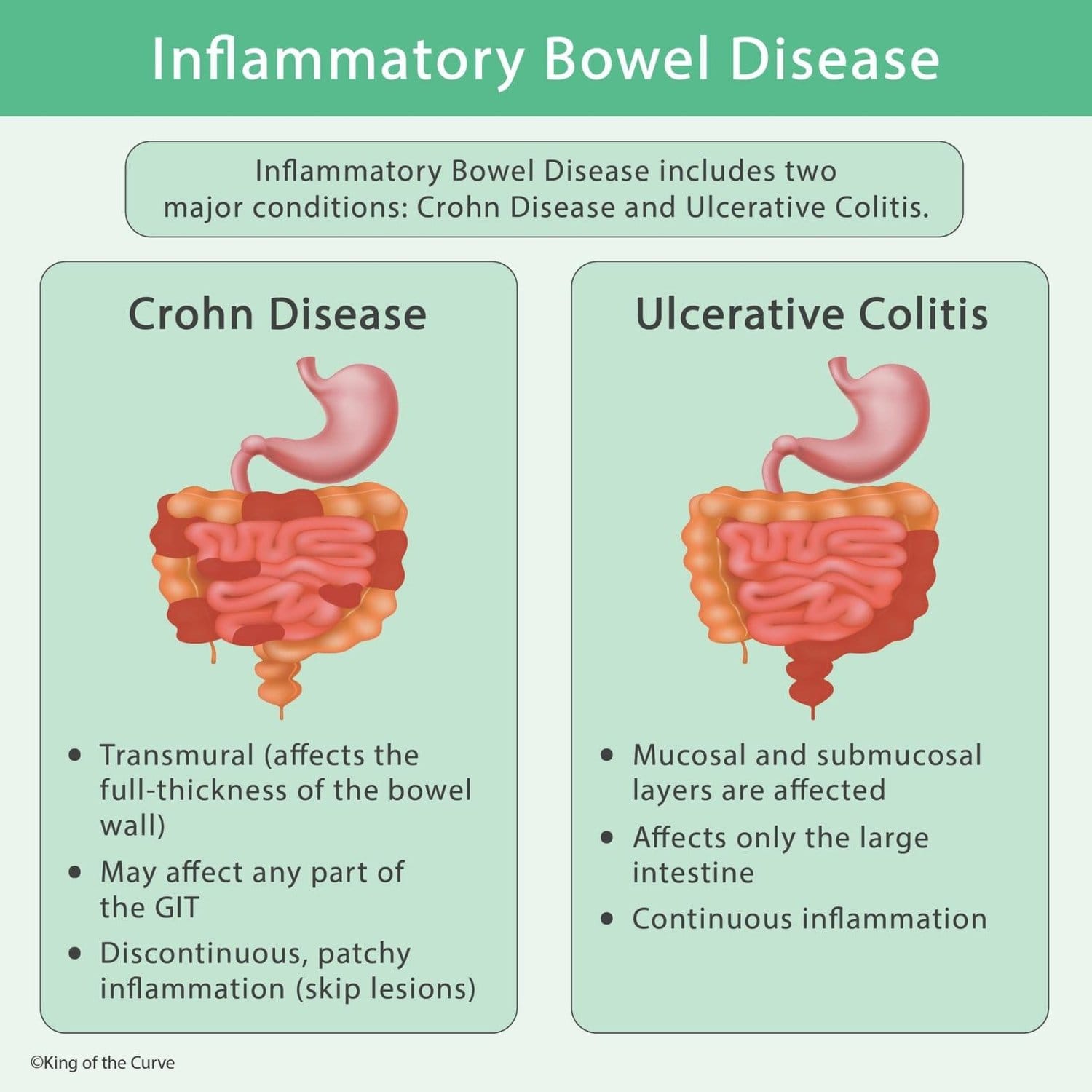 IBD
